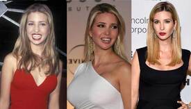 ivanka-trump-plastic-surgery-before-and-after-photos.jpg