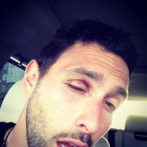 noah mills Just a little %23blackeyeprogression.jpg