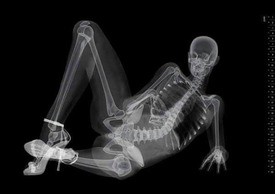 http___www.bitrebels.com_wp-content_uploads_2010_06_skeleton5.jpg