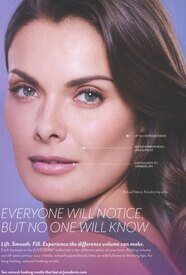 Juvederm-Allergan.jpg