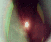 post-35528-0-1446001951-97142_thumb.gif