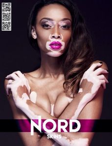 Winnie Harlow-Nord-unk.jpg