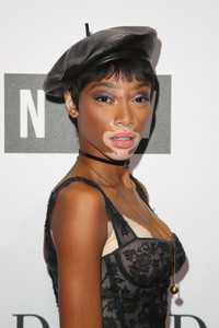 Winnie+Harlow+NGV+Gala+Arrivals+Nk-0xowmQuGx.jpg