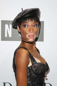 Winnie+Harlow+NGV+Gala+Arrivals+QrWyN8K2Wrzx.jpg
