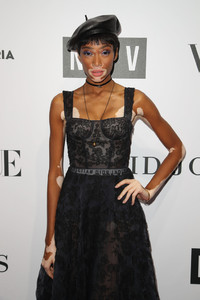 Winnie+Harlow+NGV+Gala+Arrivals+wJBMWMHzANPx.jpg