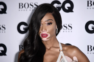 Winnie+Harlow+GQ+Men+Year+Awards+Red+Carpet+-Nd9oIHO0aVx.jpg
