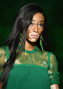 Winnie+Harlow+Elie+Saab+Runway+Paris+Fashion+RDwi1WmlCC3x.jpg