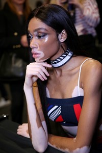 winnie-harlow-tommy-hilfiger-show-in-milan-backstage-02-25-2018-1.jpg