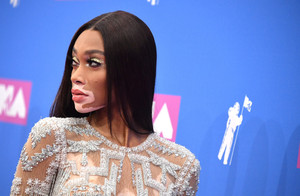 Winnie+Harlow+2018+MTV+Video+Music+Awards+kqE7vcmmuH8x.jpg