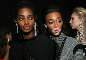 Winnie+Harlow+TRESemme+x+Prabal+Gurung+NYFW+tSwjQ6cGyIAx.jpg