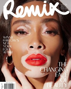 Winnie Harlow-Remix-Nova Zelandia-2.jpg