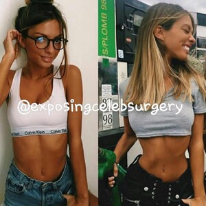 exposingcelebsurgery_50165322_343232069855866_3424839007493109613_n.jpg