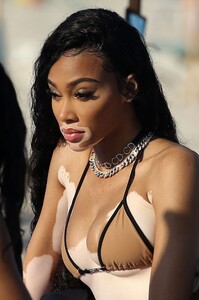 winnie-harlow-in-a-bikini-on-the-beach-in-miami-01-01-2020-5.jpg