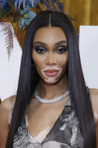 Winnie+Harlow+L+Avenue+Saks+Celebrates+First+m5WZLRqNOQpx.jpg