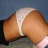 culoparriba